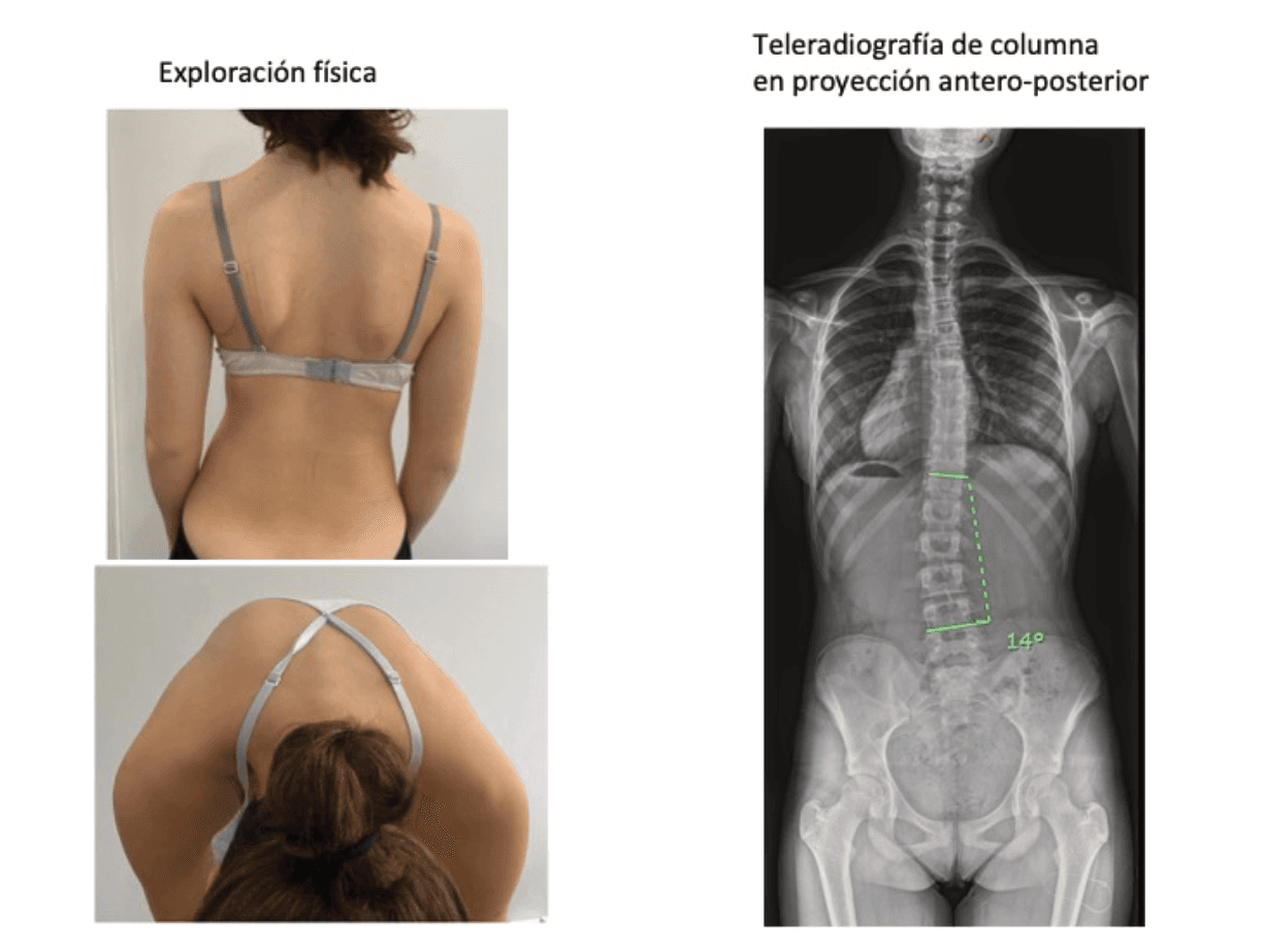 Imagen 8 de la pregunta 8 del MIR 2024